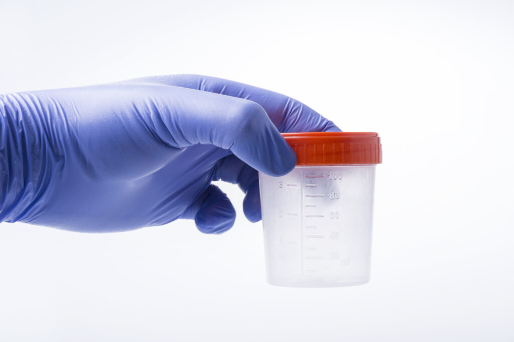 On-site Drug Testing for Employers- TestSource Lab